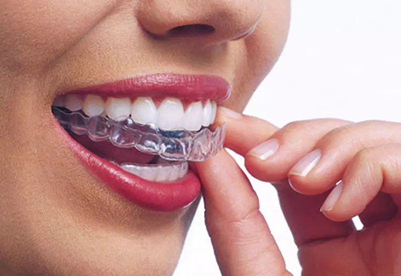 invisalign-berlin-kudamm1