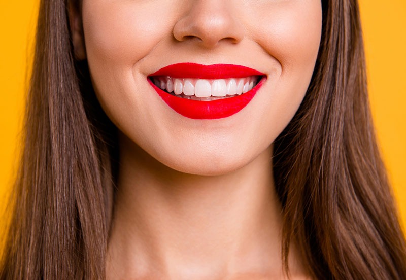 prophylaxe-berlin-kudamm2 Frau lächelt mit roten Lippenstift und sauberen weißen Zähnen